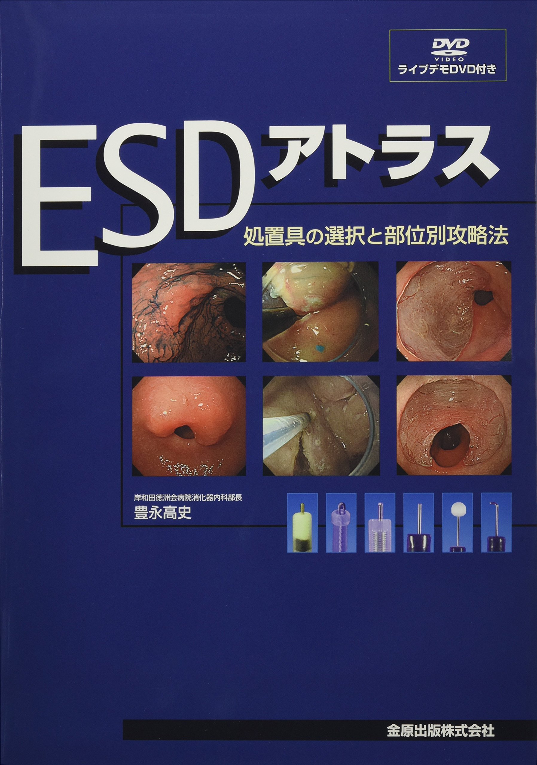 Amazon.co.jp: ESDアトラス: 処置具の選択と部位別攻略法 : 豊永高史