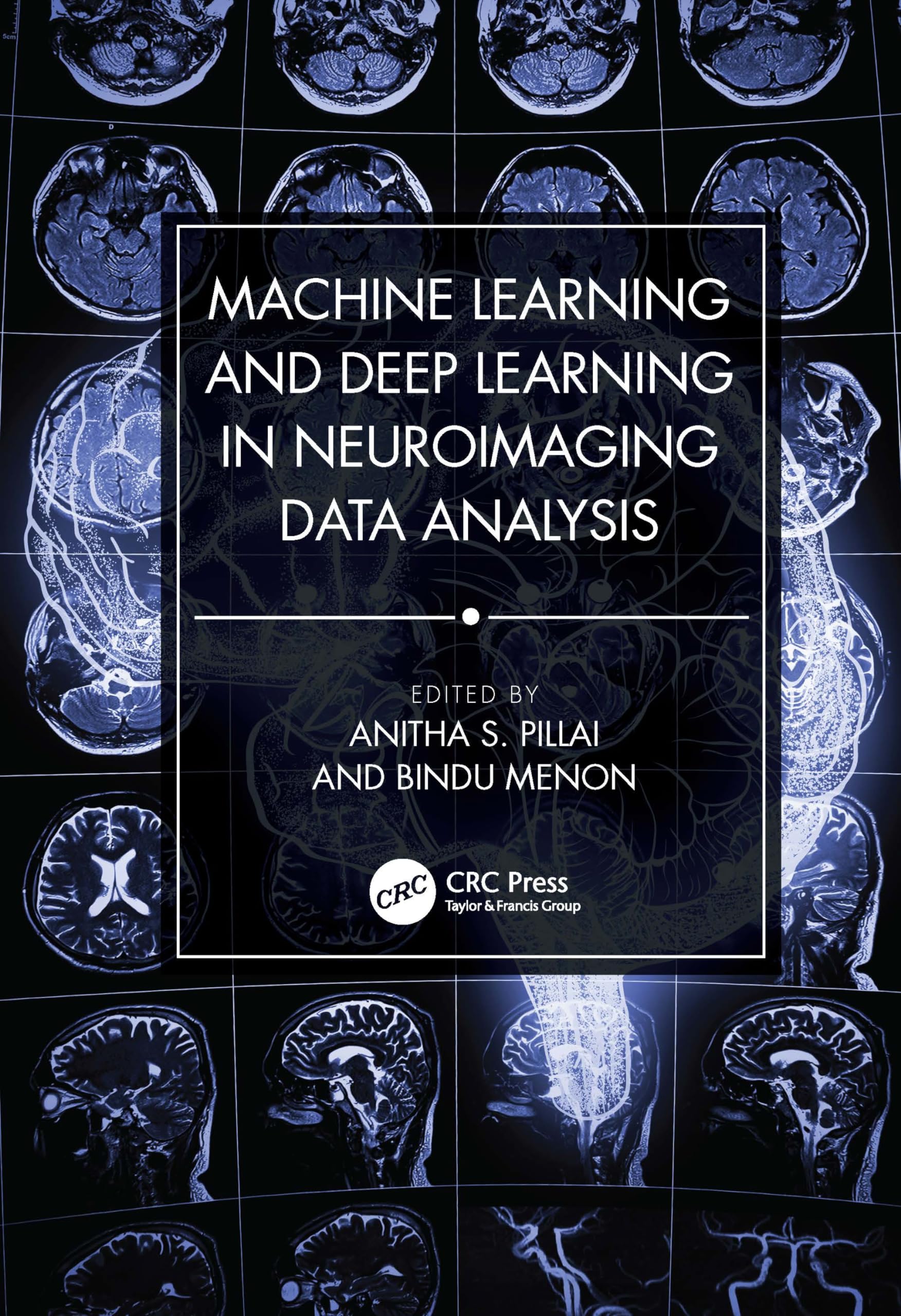 Buy Machine Learning and Deep Learning in Neuroimaging Data Analysis ā BookShops.in