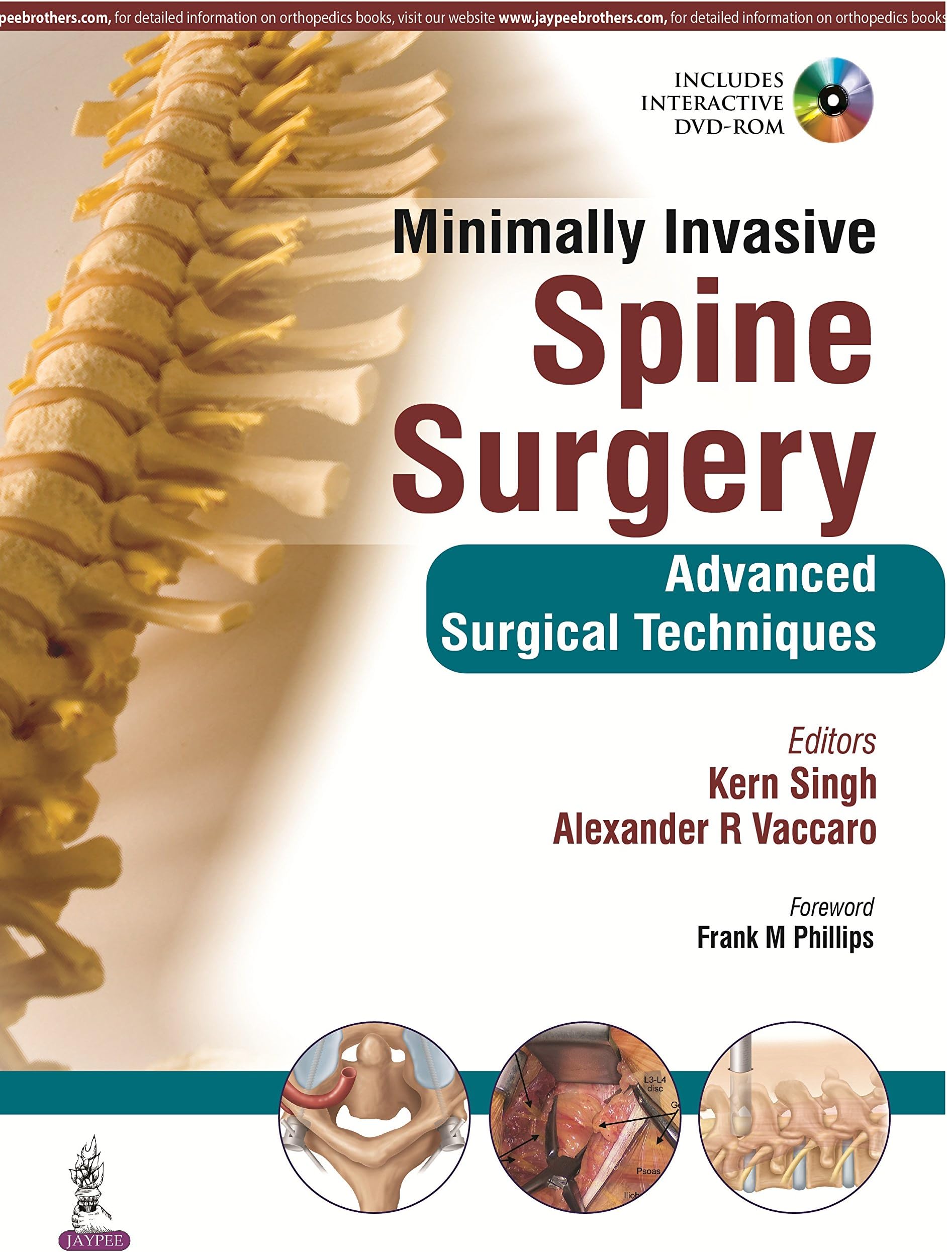 Minimally Invasive Spine Surgery: Advanced Surgical Techniques 1st Edition