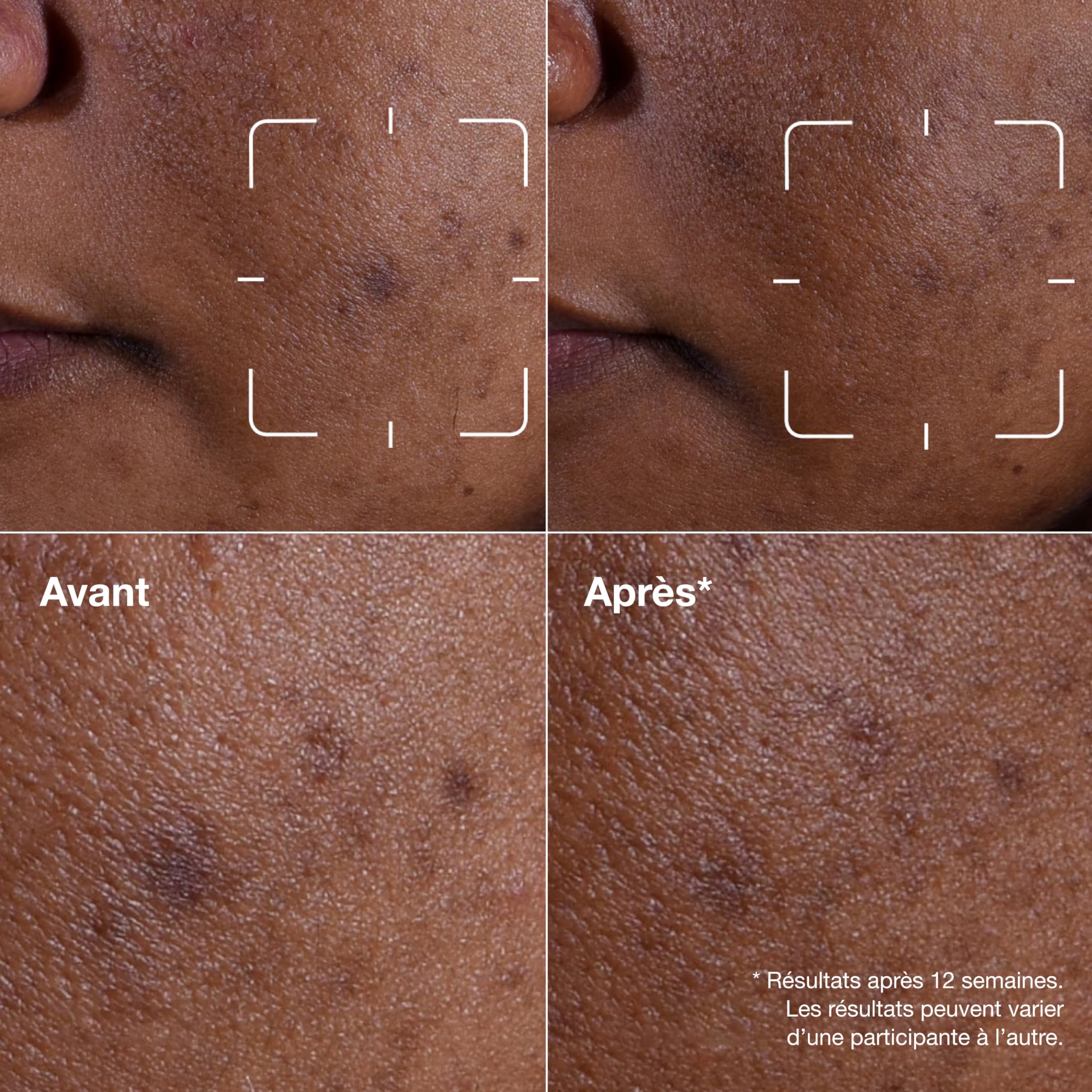 Clinique Even Better Clinical Sérum Illuminateur Anti-Taches à la Vitamine C | Sérum Visage Illuminateur Apaisant