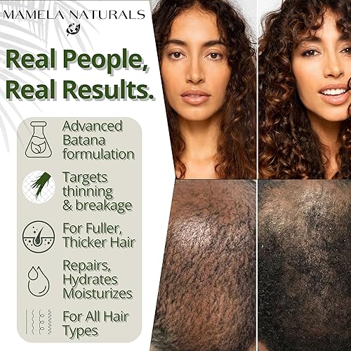 Miniatura 6 de Aceite de batana para el crecimiento del cabello, mezcla 100% pura y natural con romero crudo y orgánico, almendra, aceite de menta, para cabello