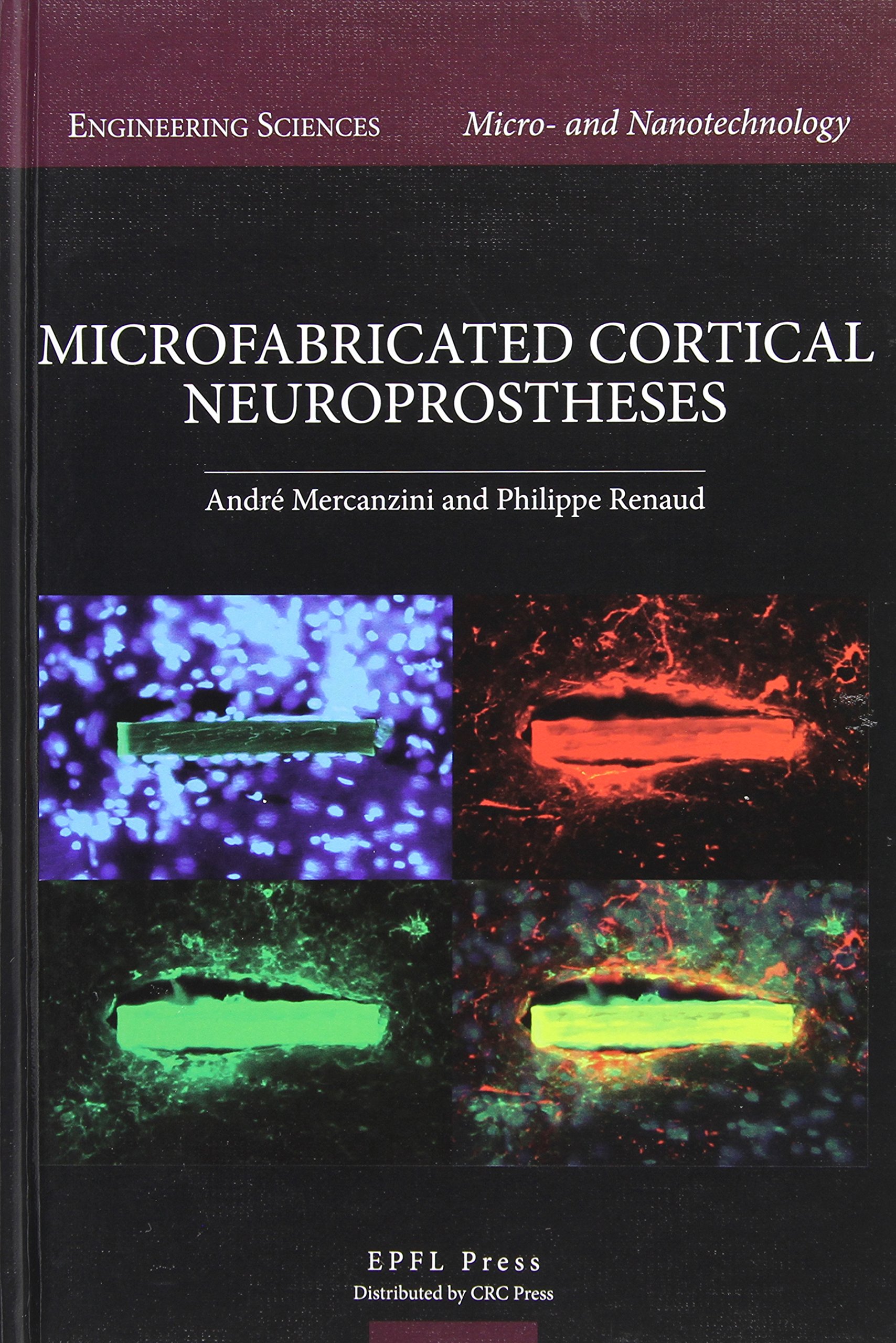 Buy Microfabricated Cortical Neuroprostheses (Engineering Sciences: Micro- and Nanotechnology) — BookShops.in