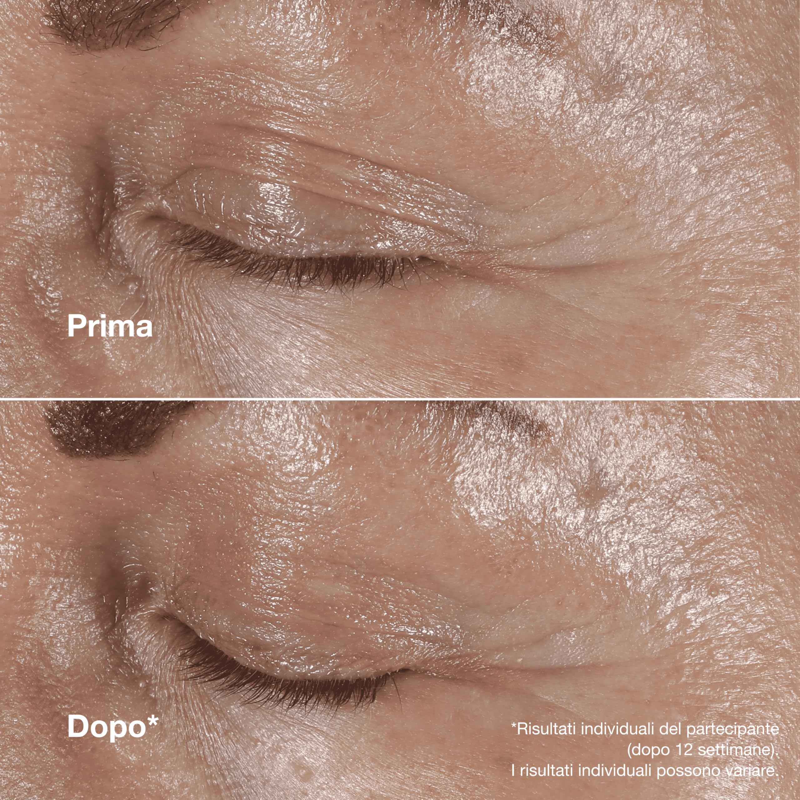 Clinique Smart Clinical Repair Wrinkle Correcting Eye Cream | Crema contorno occhi anti-età