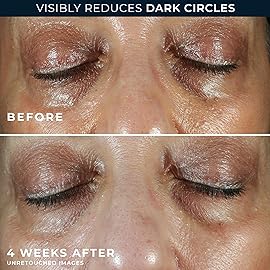 RoC Multi Correxion 5 in 1 Anti-Aging Eye Cream for Puffiness, Under Eye Bags & Dark Circles, Skin Care Treatment with Shea Butter, (.5 oz) with Night Cream Packette (Packaging May Vary)