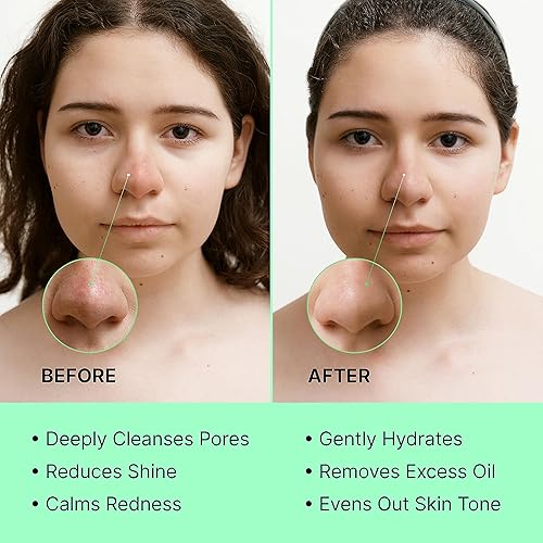 Miniatura 4 de Máscara de té verde en barra  Limpiador de poros Green Stick  Previene puntos negros  Limpieza profunda de arcilla hidratante  Máscaras faciales