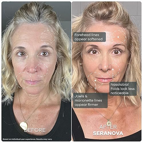 Vista 5 de Seranova Micro Infusión para el Cuidado de la Piel, Esencia Hidratante Facial, Suero Facial para una Piel Lisa para Todos los Tipos de Piel