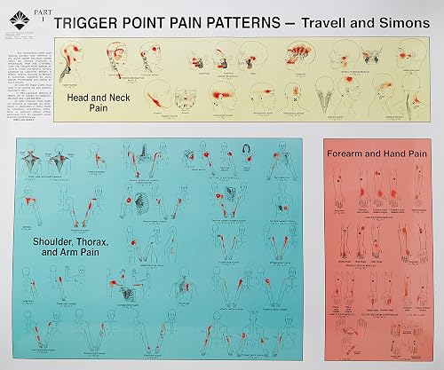 Trigger Point Pain Patterns Wall Charts: Upper and Lower Extremity