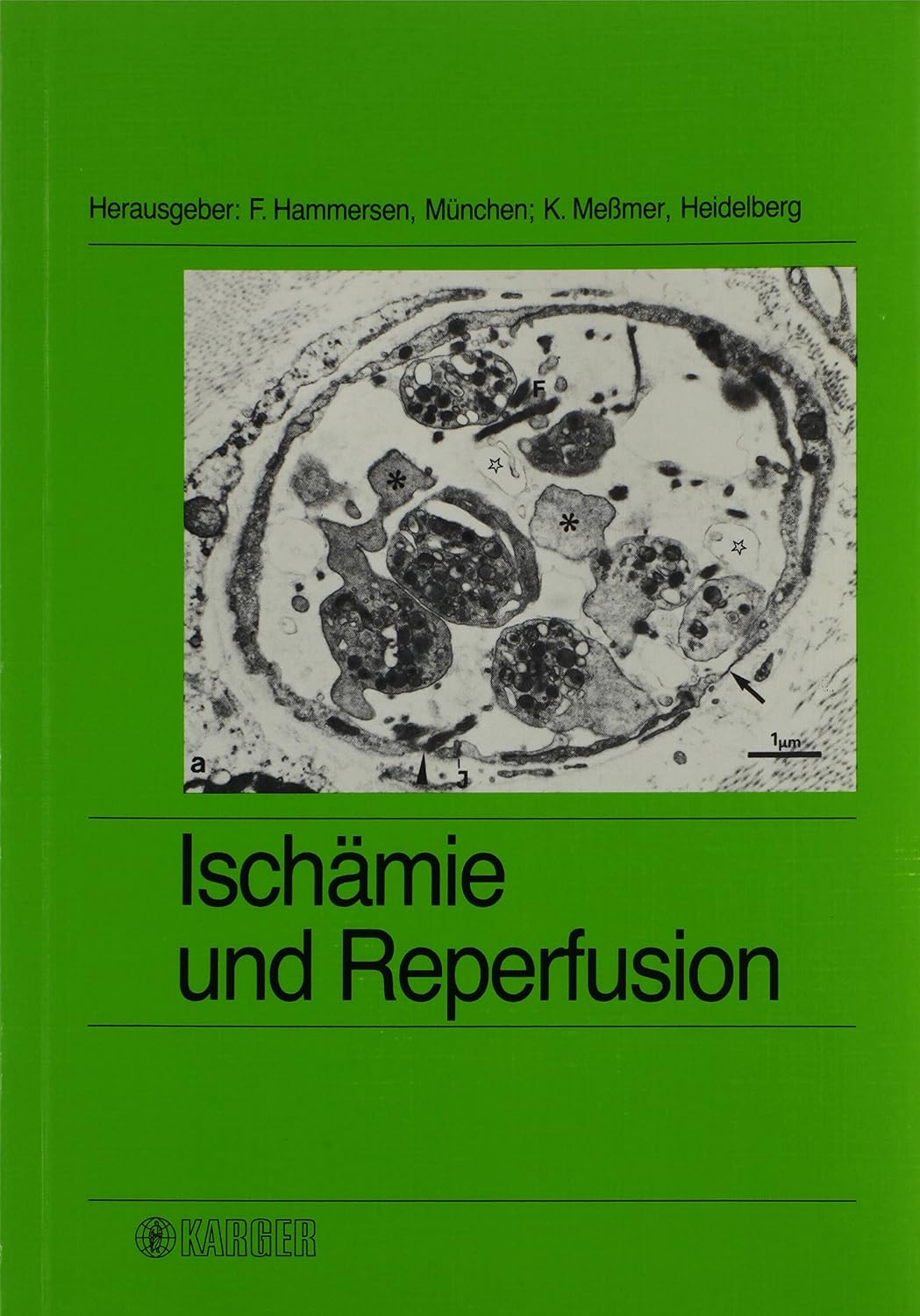 Ischamie Und Reperfusion      First Edition