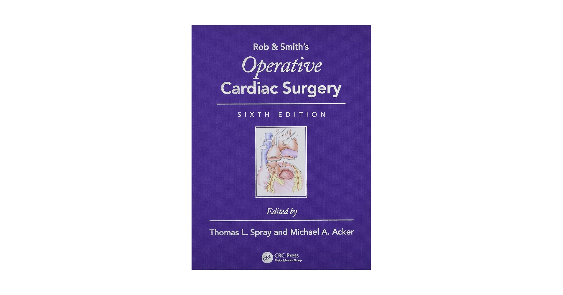 Operative Cardiac Surgery (Rob & Smith's Operative Surgery