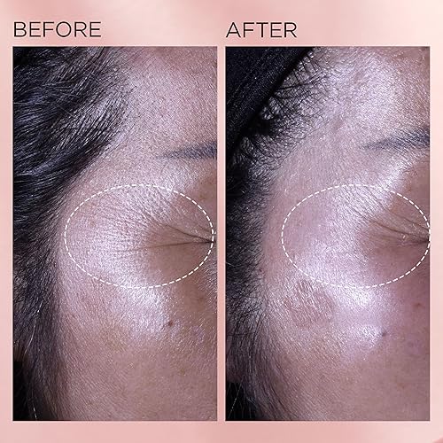 Miniatura 9 de Elizabeth Arden Retinol + HPR Ceramide Rapid Skin Renewing Anti-Aging Face Serum Capsules, tratamiento de líneas finas y arrugas con péptidos,