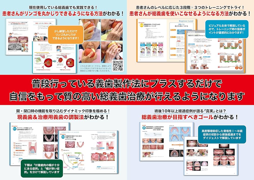 Amazon.co.jp: 患者さんが総義歯を使いこなすためのトレーニング法と