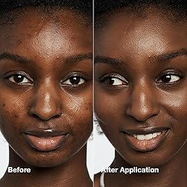 Clinique Even Better Makeup Liquid Foundation SPF 15 With Vitamin C For Dry + Oily Combination Skin Types | Medium Coverage + Natural Finish | Evens Skin Tone + Reduces Dark Spots, Sienna, 1 Fl Oz