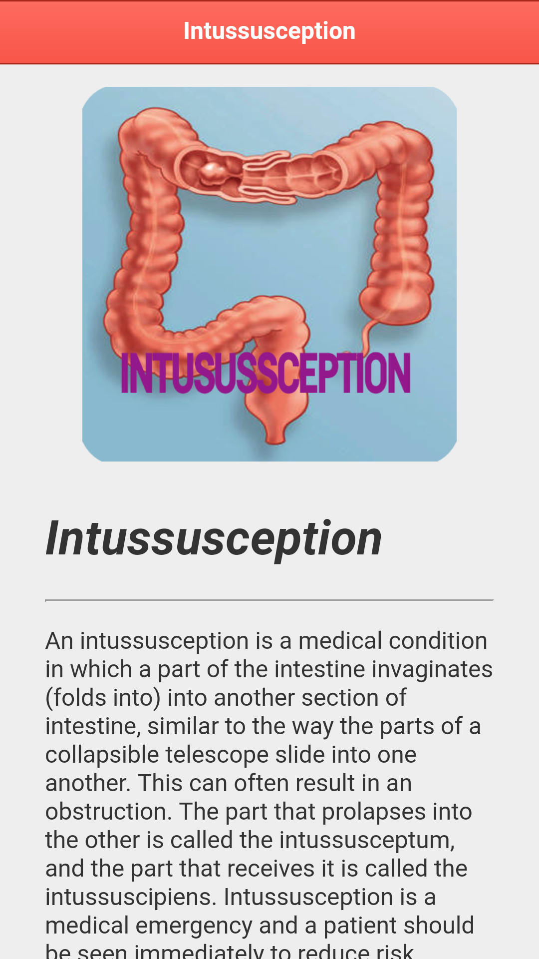 Intussusception Disease - App on the Amazon Appstore