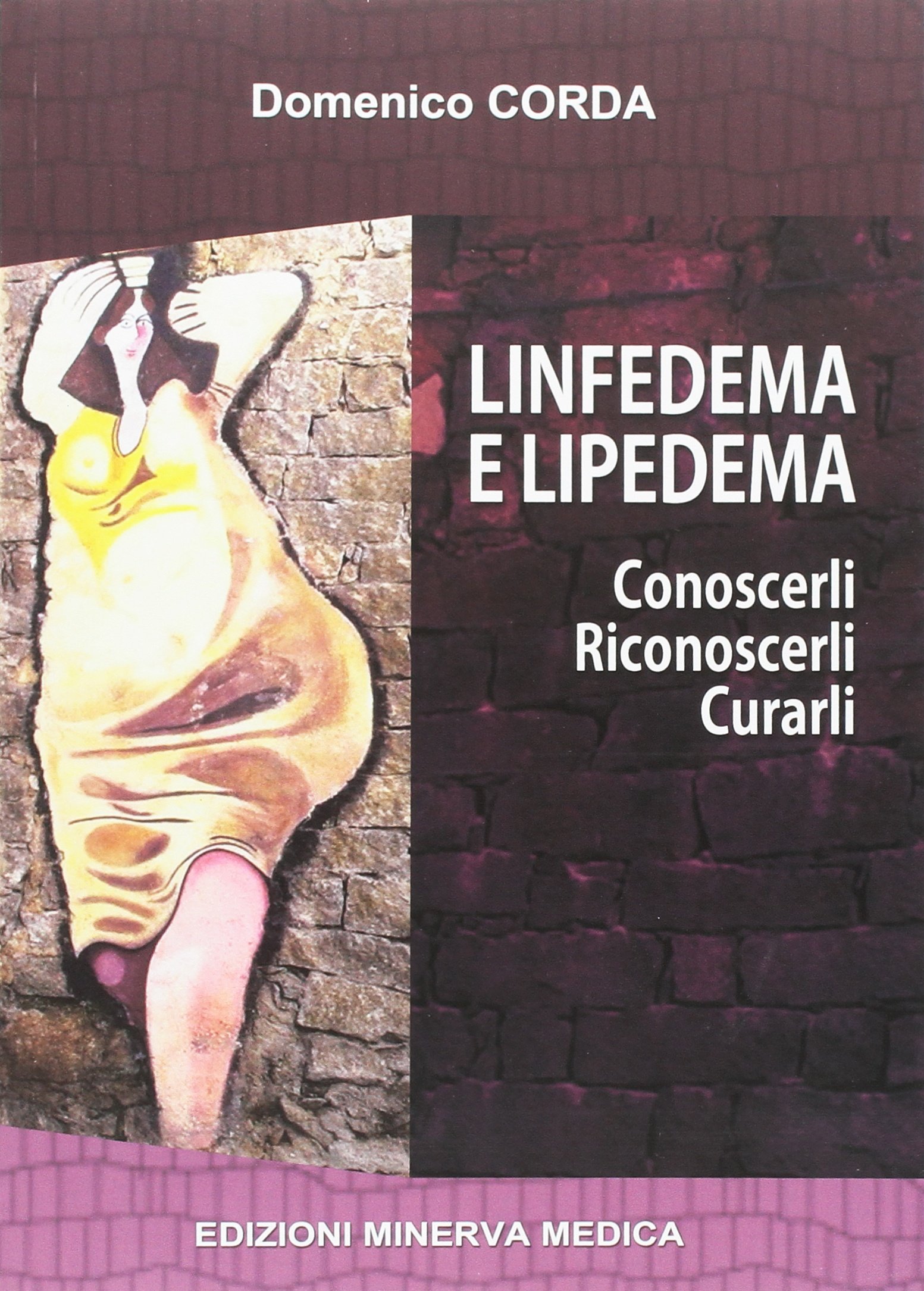 Minerva Linfedema e lipedema. Conoscerli. Riconoscerli. Curarli