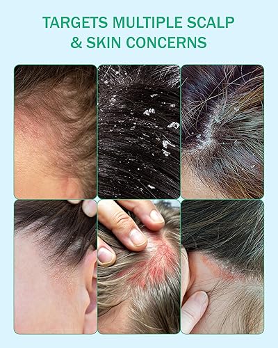 Miniatura 7 de Champú en crema para eczema para pieles sensibles para niños y adultos, calostro y avena coloidal, champú anticaspa en el cuero cabelludo, para