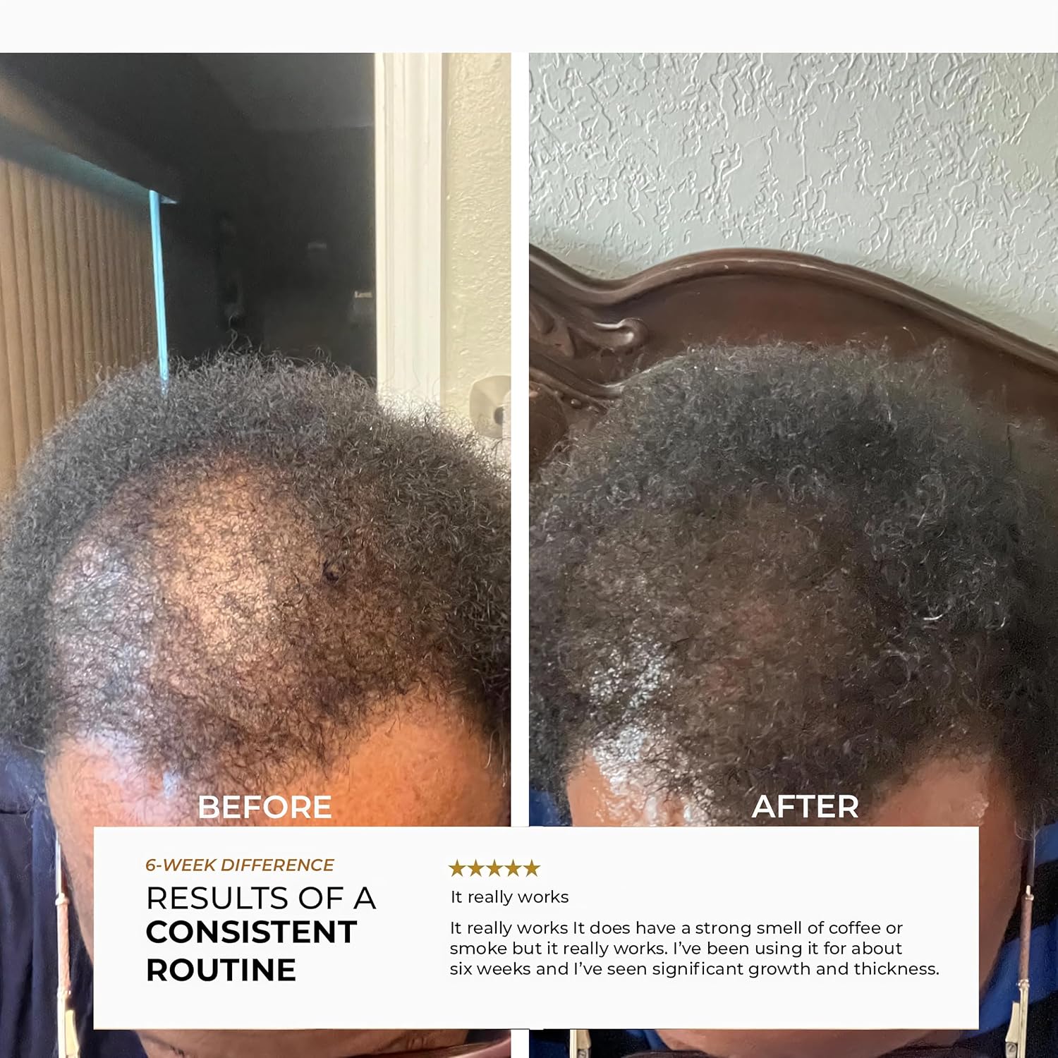 Unrefined Batana Oil for Hair Growth - 100% Raw Unrefined Batana Oil from Honduras - Dr. Sebi Approved Pure Hair Treatment for Thicker Hair - 4oz - Image 5