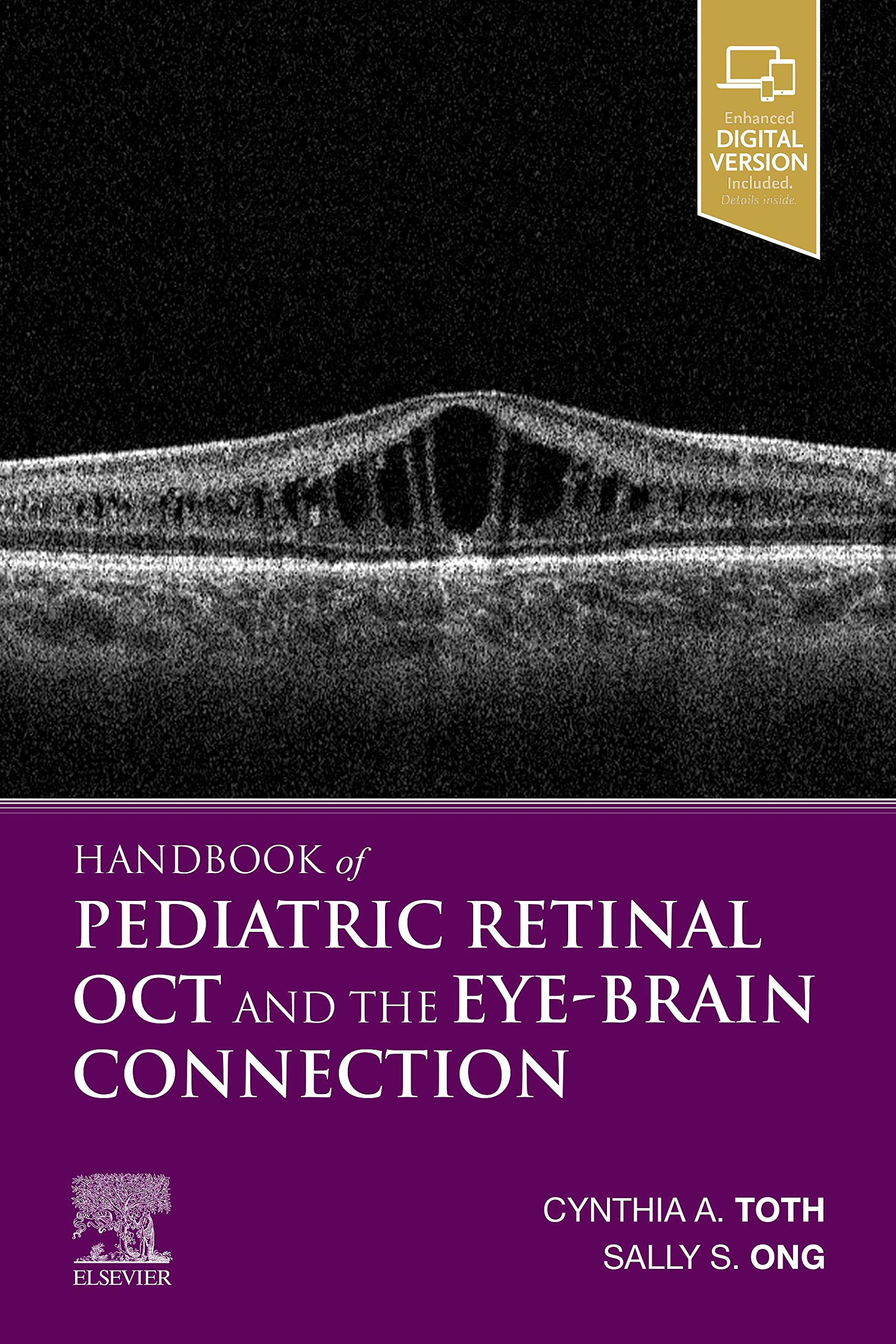 Handbook of Pediatric Retinal OCT and the Eye-Brain Connection ...