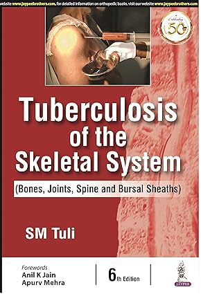 TUBERCULOSIS OF THE SKELETAL SYSTEM (BONES, JOINTS, SPINE AND BURSAL SHEATHS)