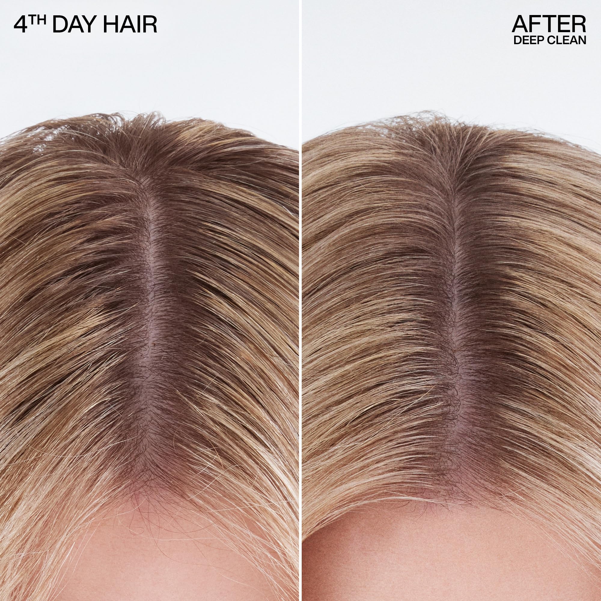 Redken, Champú en Seco en Spray, Elimina Exceso de Grasa Capilar, Sensación de Frescura, Para Todo Tipo de Pelo, 150 ml