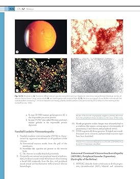 眼科病理:希少洋書専門書Ophthalmic Pathology 眼科病理:希少洋書専門書Ophthalmic Pathology 眼科病理:希少