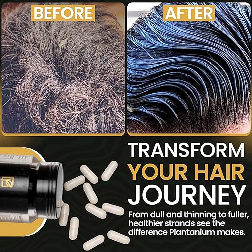 Miniatura 7 de Las mejores vitaminas para el crecimiento del cabello para mujeres y hombres apoyan el crecimiento del cabello más rápido y una mejor salud del