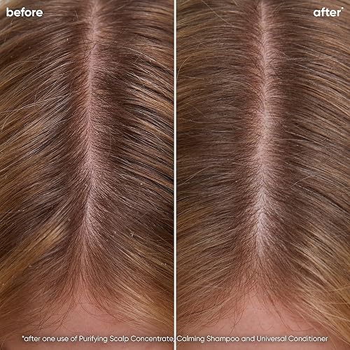 Miniatura 2 de Biolage Champú calmante Scalp Sync  Calma e hidrata el cuero cabelludo seco o irritado  Sin parabenos ni silicona  Para control de sensibilidad