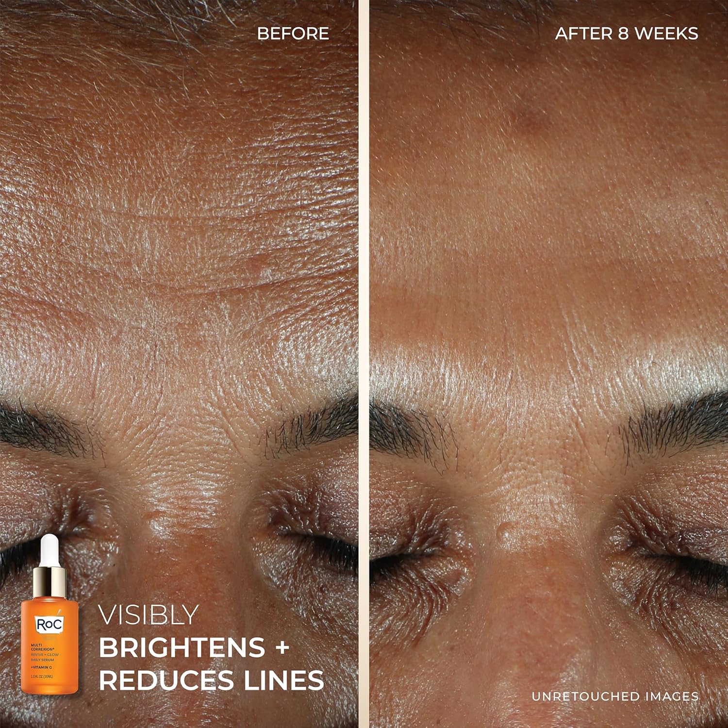 RoC Multi Correxion Revive + Glow Skin Care Regimen Bundle: Vitamin C Serum for Face + Vitamin C Cream for Tighter, Brighter Skin