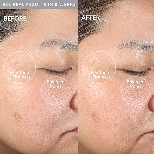 The PMD Clean is a cutting-edge smart facial cleansing device designed to provide a deep and rejuvenating cleanse for your skin. This device utilizes silicone brush and anti-aging massager attachments to address various skin concerns and deliver a spa-like experience in the comfort of your own home.