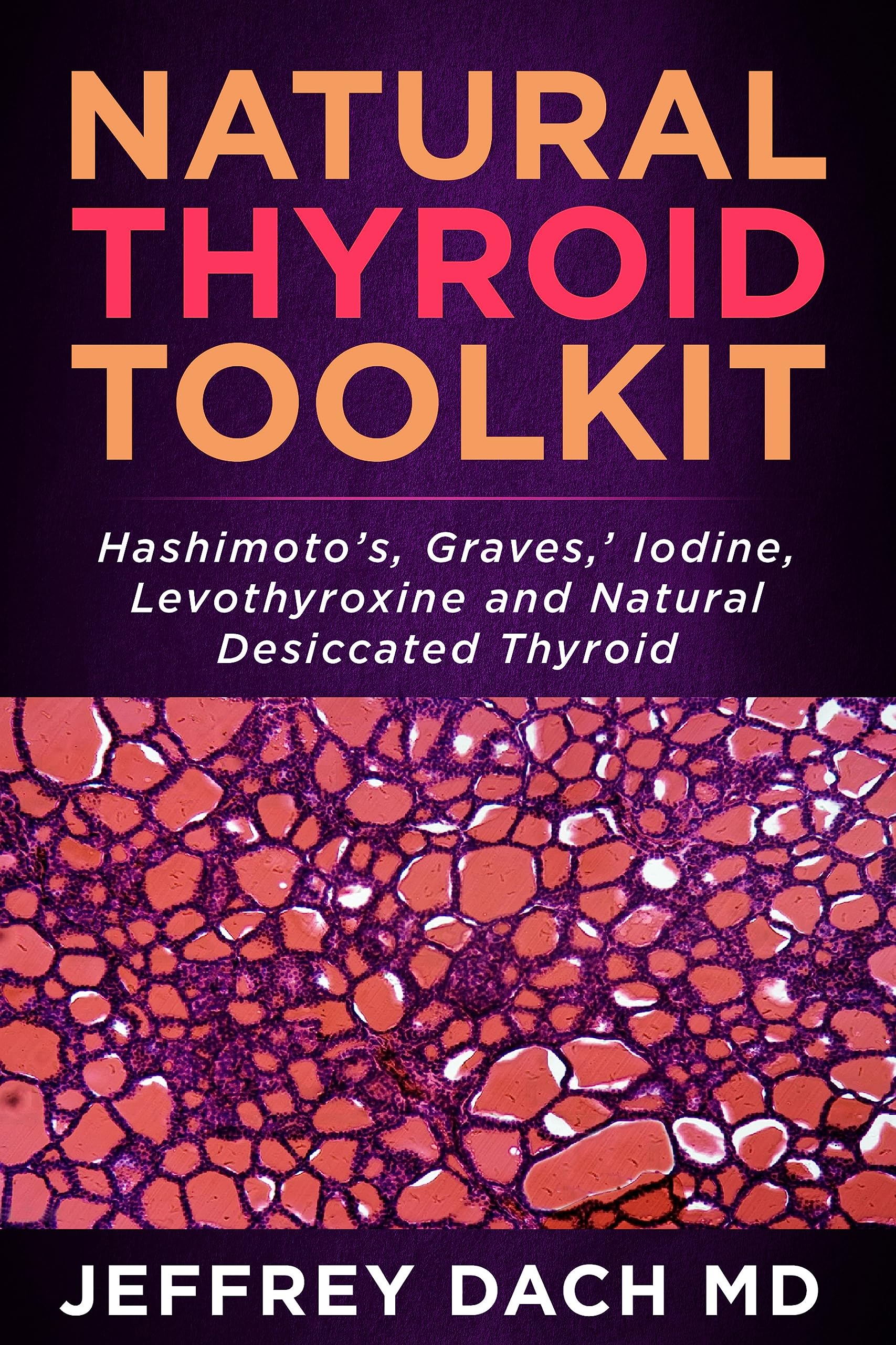 Natural Thyroid Toolkit: Hashimoto’s, Graves,’ Iodine and Natural Desiccated Thyroid