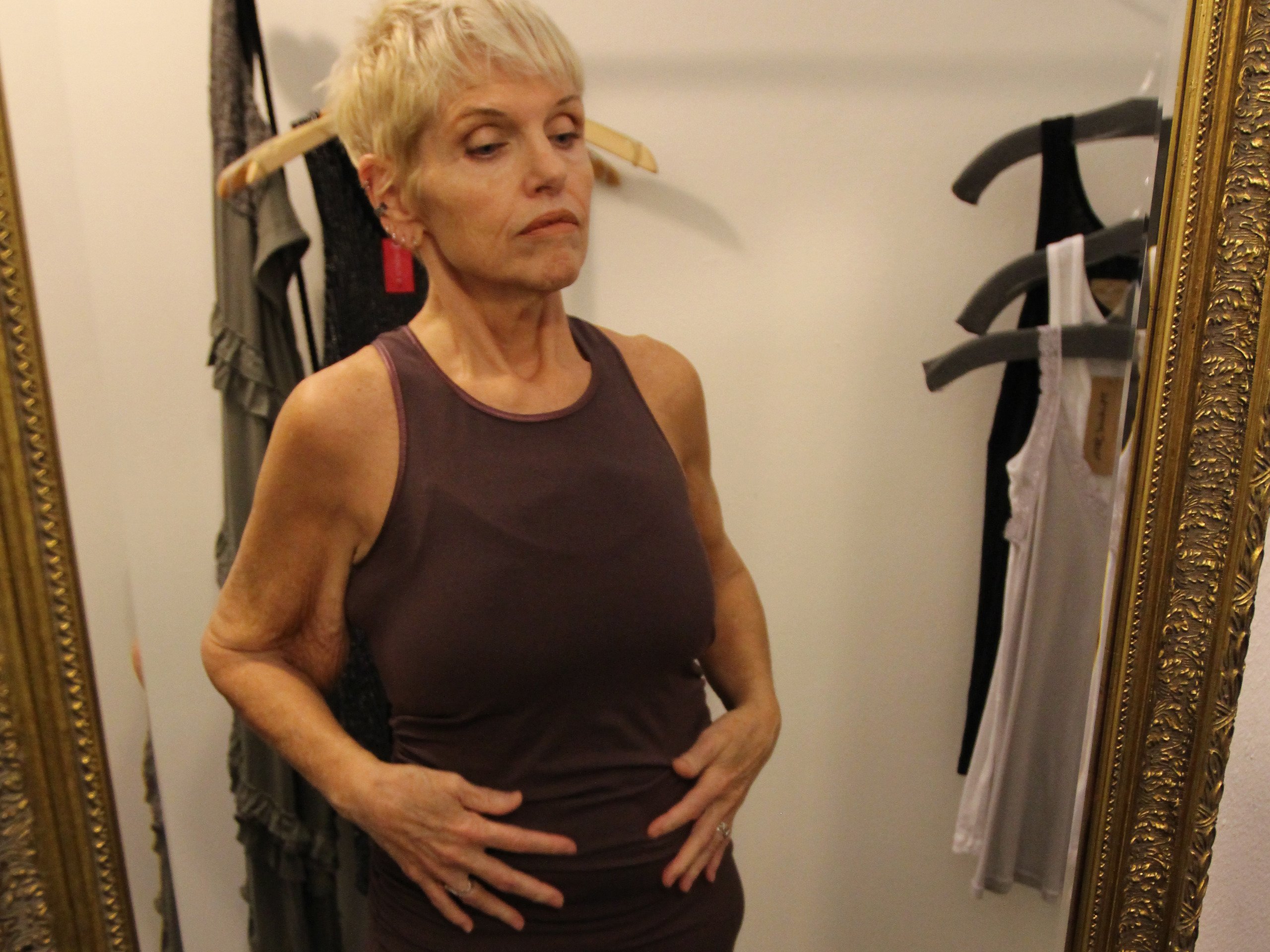 Watch My Extreme Excess Skin Season 3 Prime Video(02)