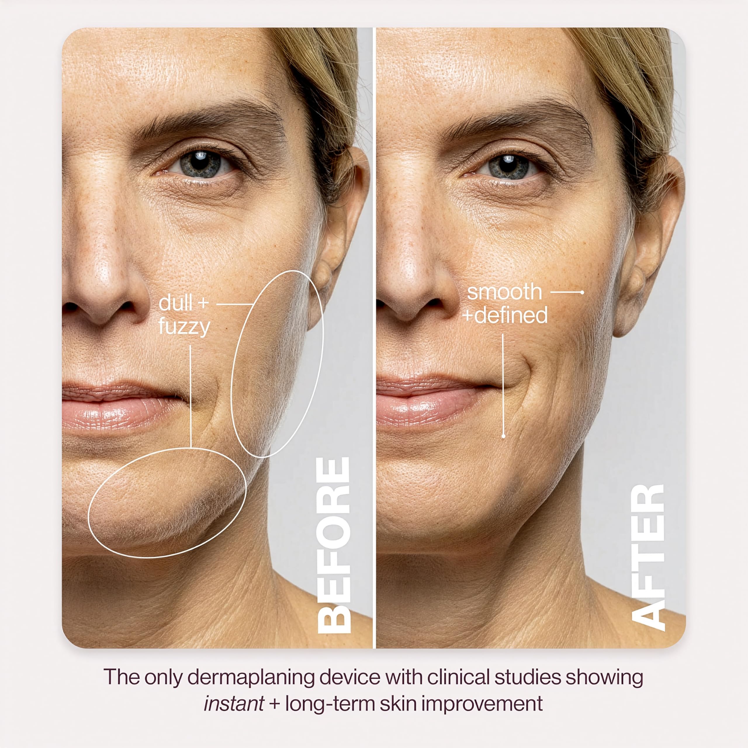 DERMAFLASH Urządzenie LUXE plus, narzędzie przeciwstarzeniowe, złuszczające, usuwanie włosów i dermaplaning z technologią Sonic Edge i 4 tygodnie leczenia, kamień