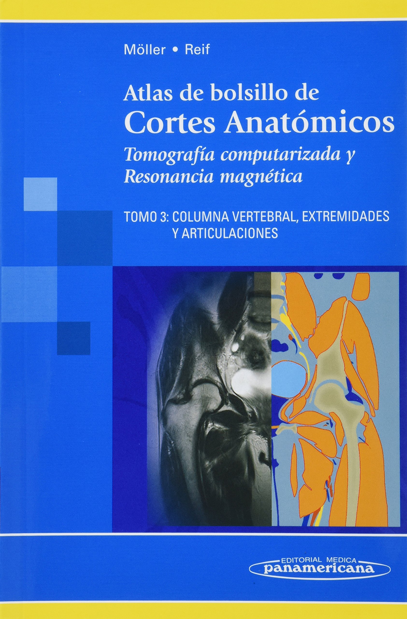 Buy Atlas de bolsillo de Cortes Anatómicos. Tomografía computarizada y Resonancia Magnética Buy Atlas de bolsillo de Cortes Anatómicos. Tomografía computarizada y Resonancia Magnética
