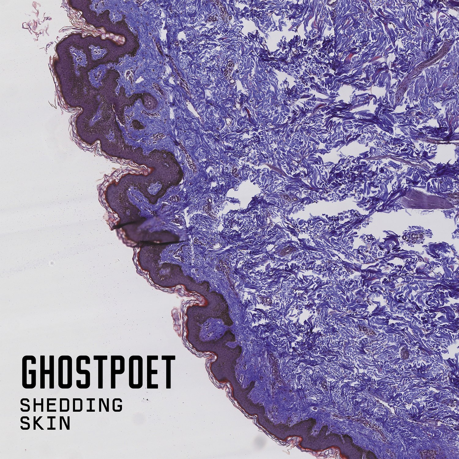 Shedding Skin [VINYL]