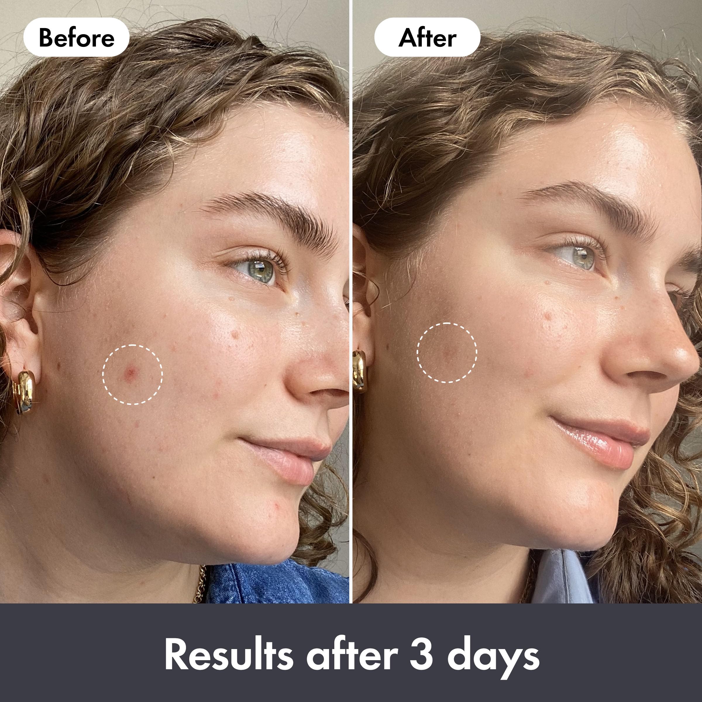 Hero Cosmetics Rescue Balm Post-Blemish Recovery Cream - Image 3