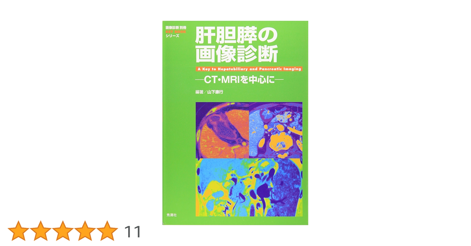 肝胆膵のCT・MRI 肝胆膵のCT・MRI | 本田浩, 角谷眞澄, 吉満研吾, 蒲田敏文, 入江