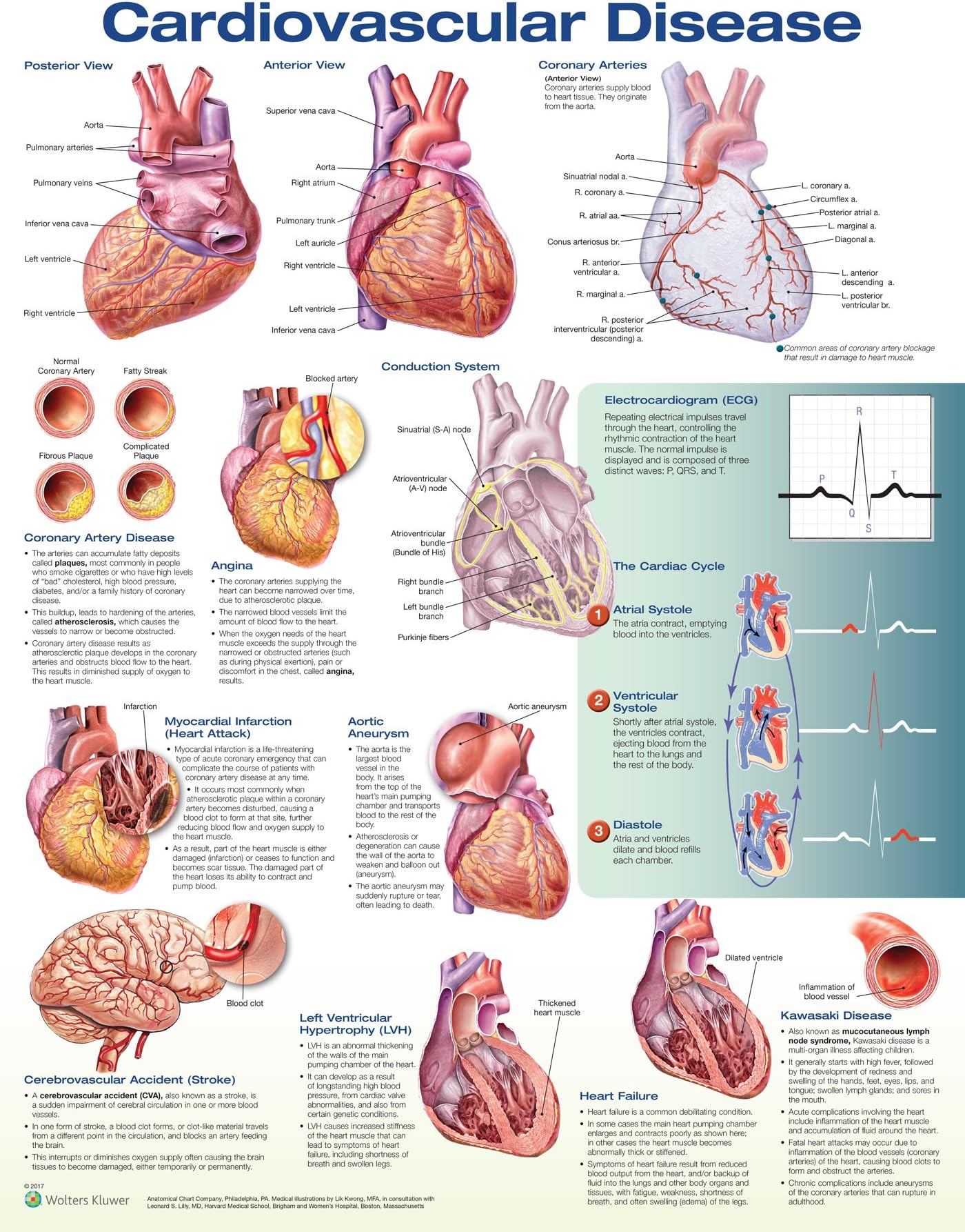 Cardiovascular Disease