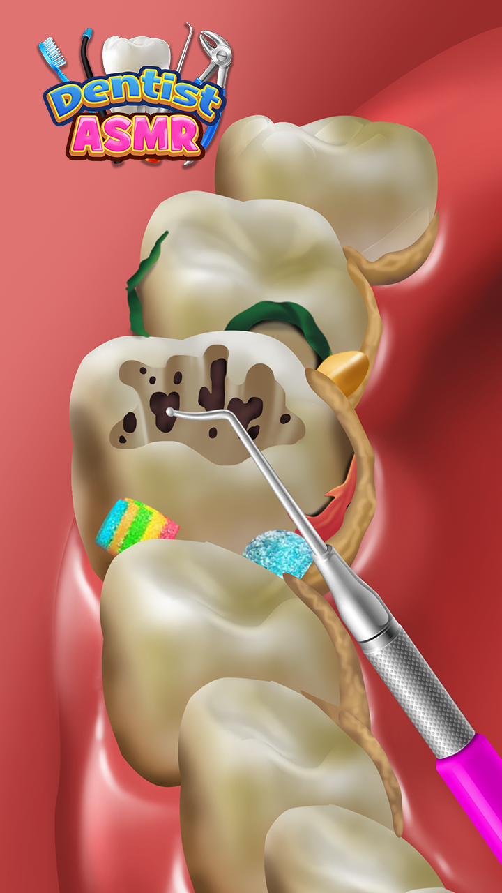 Dentist Office - Dental Teeth & Root Canal Simulator Kids Surgery Games ...