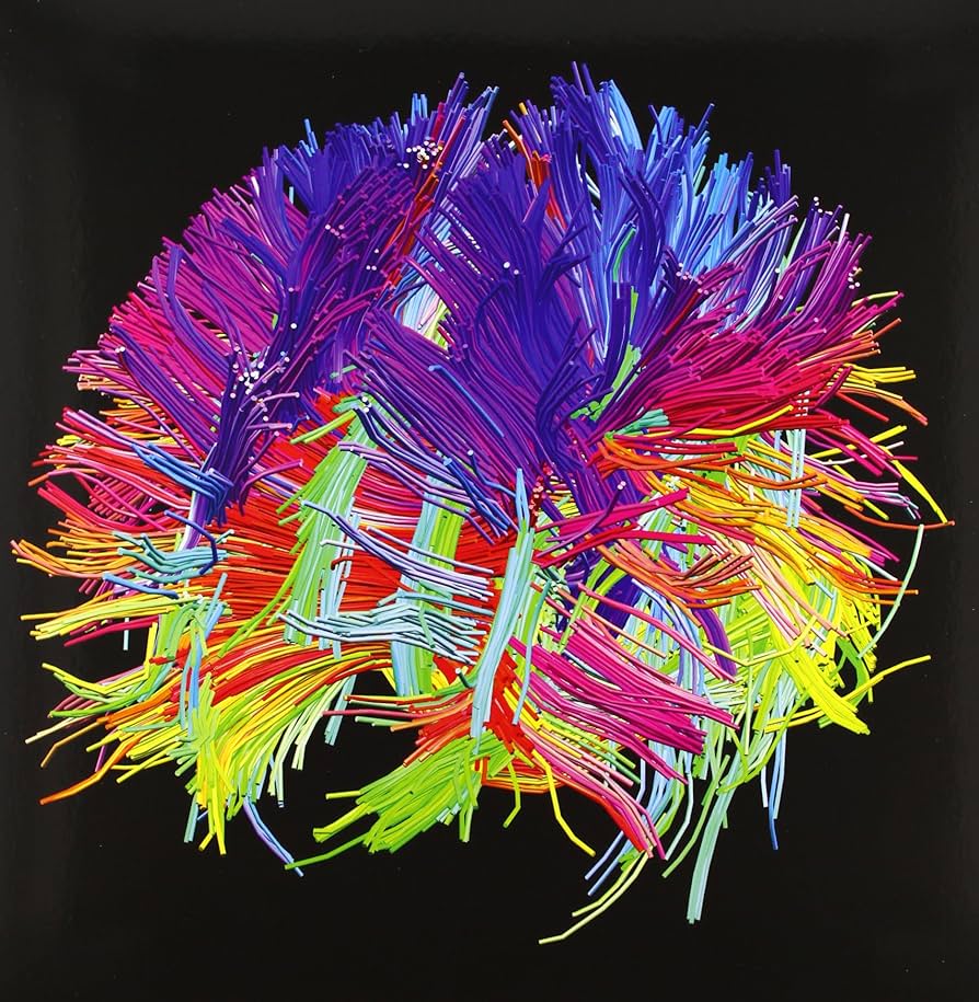 The 2nd Law [Box Set] by Muse: Amazon.co.uk: CDs & Vinyl