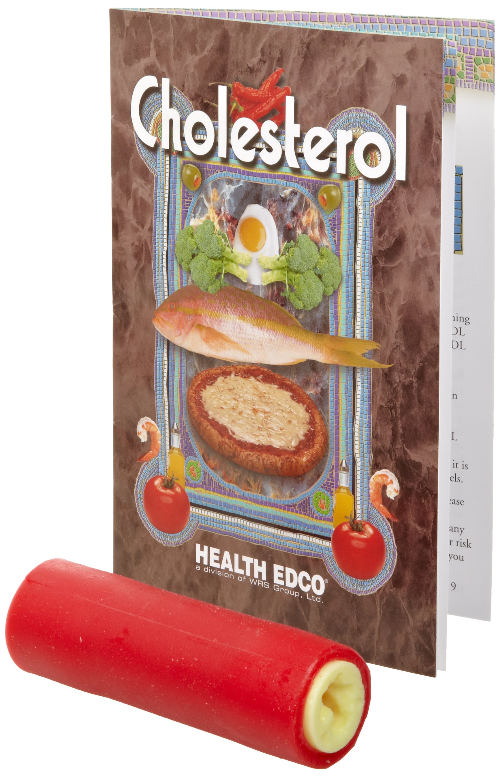 Amazon.com: HEALTH EDCO W43262 Clogged Artery Model : Industrial &  Scientific