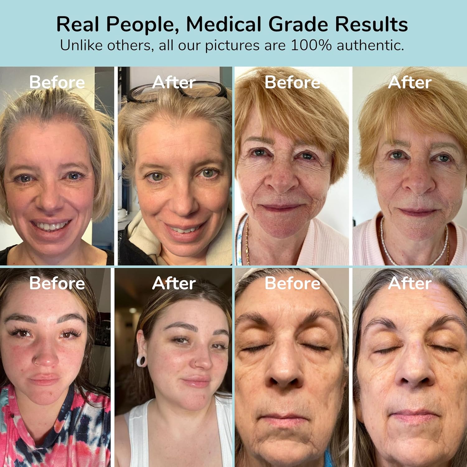 Red Light Therapy Mask, FDA Cleared, Medical Grade, Infrared Red Light Therapy for Face to Reduce Wrinkles, Redness, Improve Skin Tone, Red Light Mask