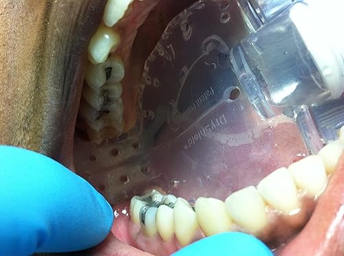 Adaptador de reducción de aerosoles dentales para ISOLITEDRYSHIELD + 4 piezas de boca