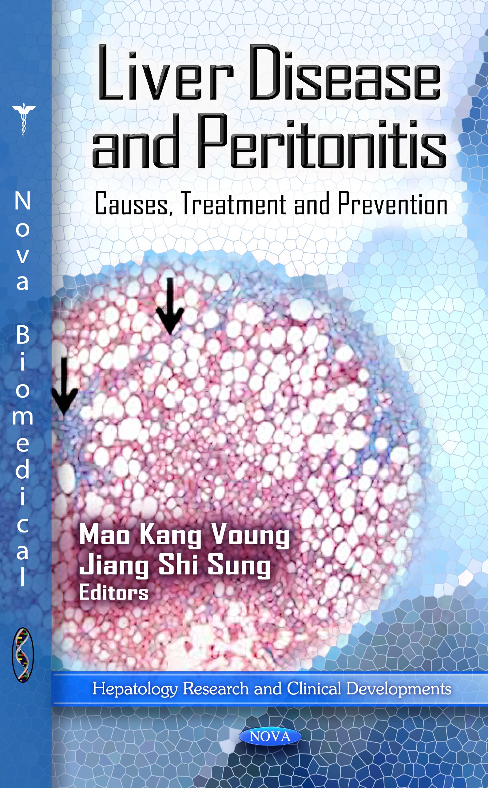 Buy Liver Disease and Peritonitis: Causes, Treatment and Prevention (Hepatology Research and Clinical Developments) — BookShops.in