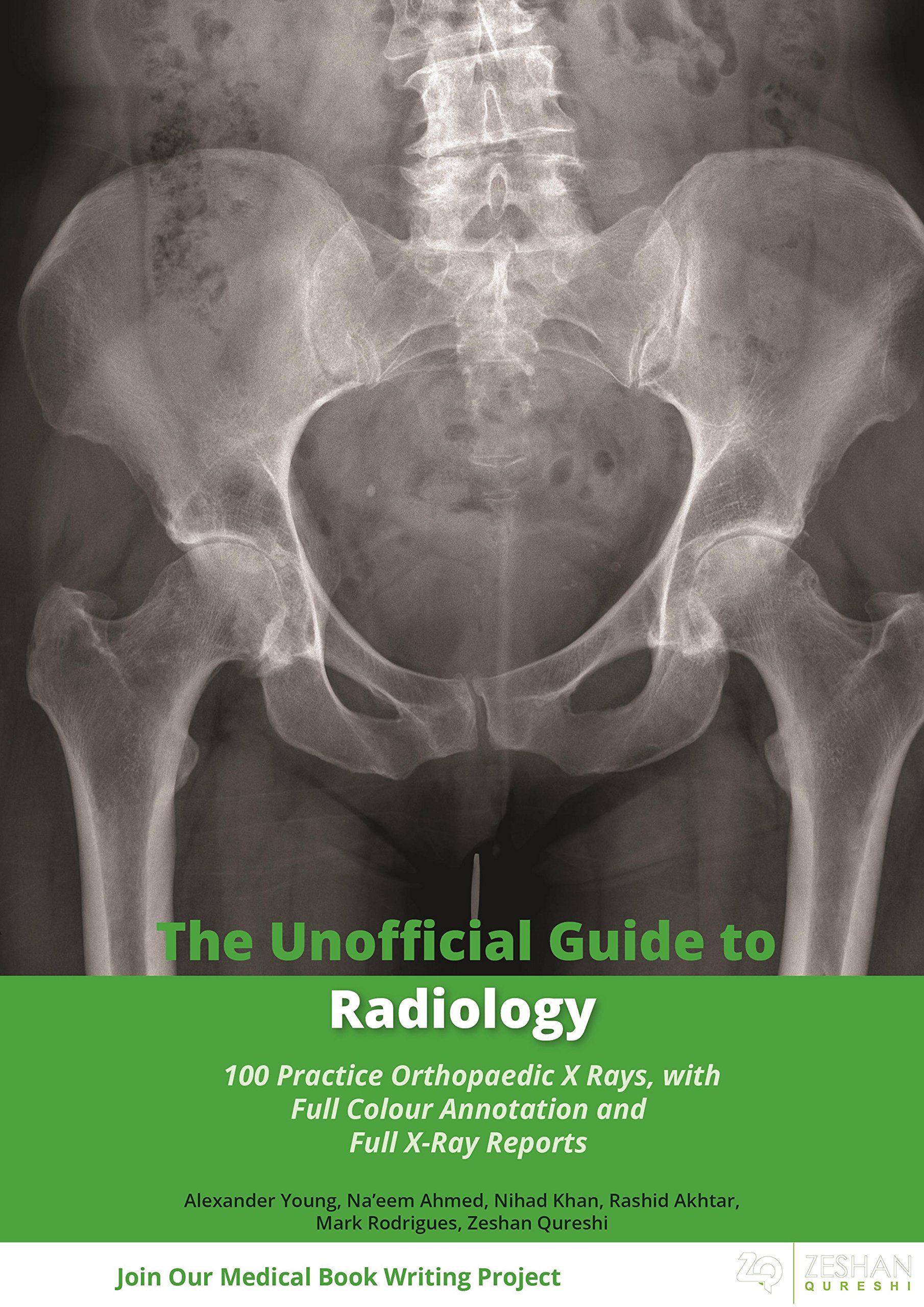 Buy The Unofficial Guide to Radiology 100 Practice Orthopaedic X Rays