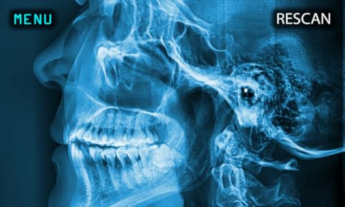 X-Ray Scanner Human Teeth