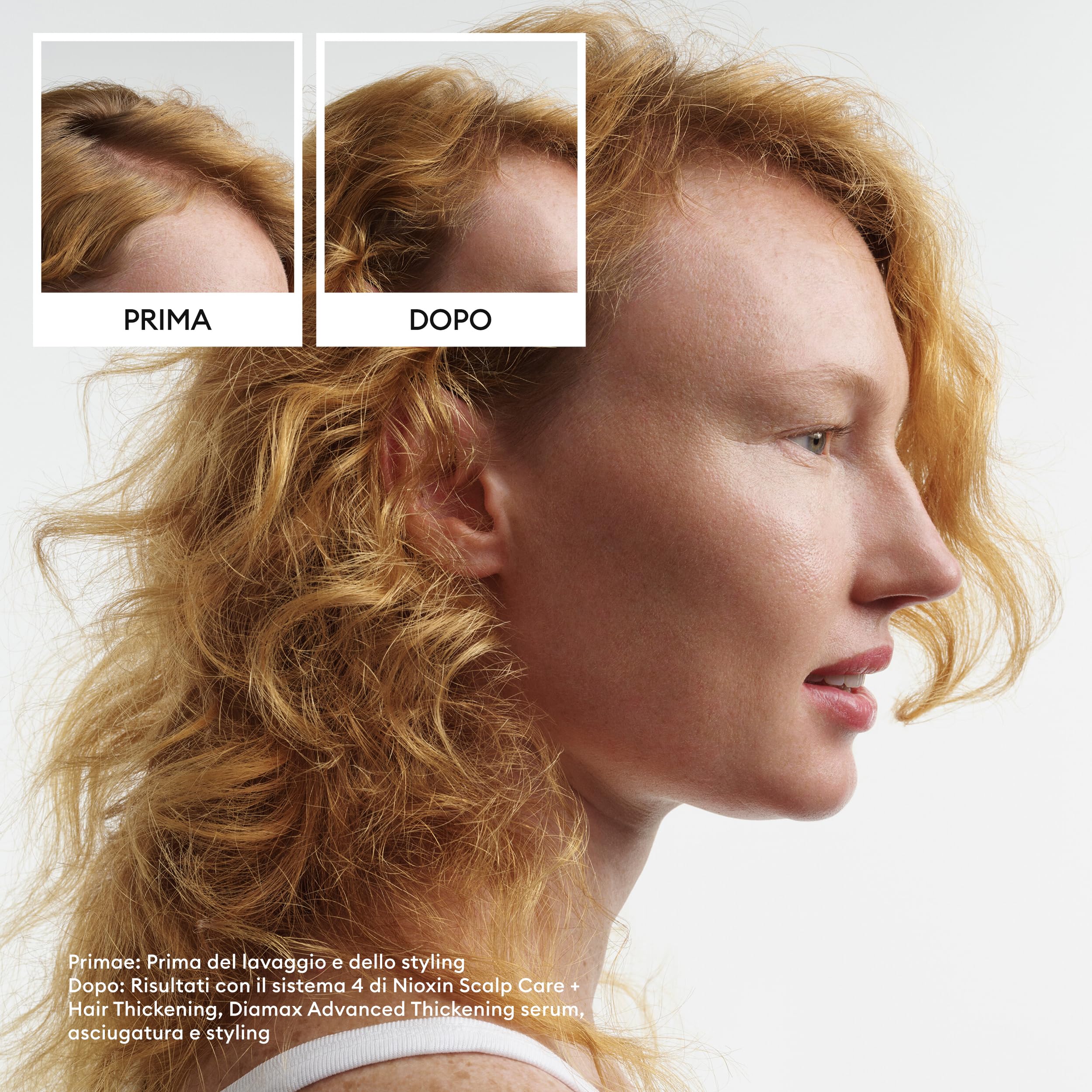 Nioxin Sistema 4 Shampoo Balsamo Trattamento Cute per Capelli Colorati Secchi Assottigliamento