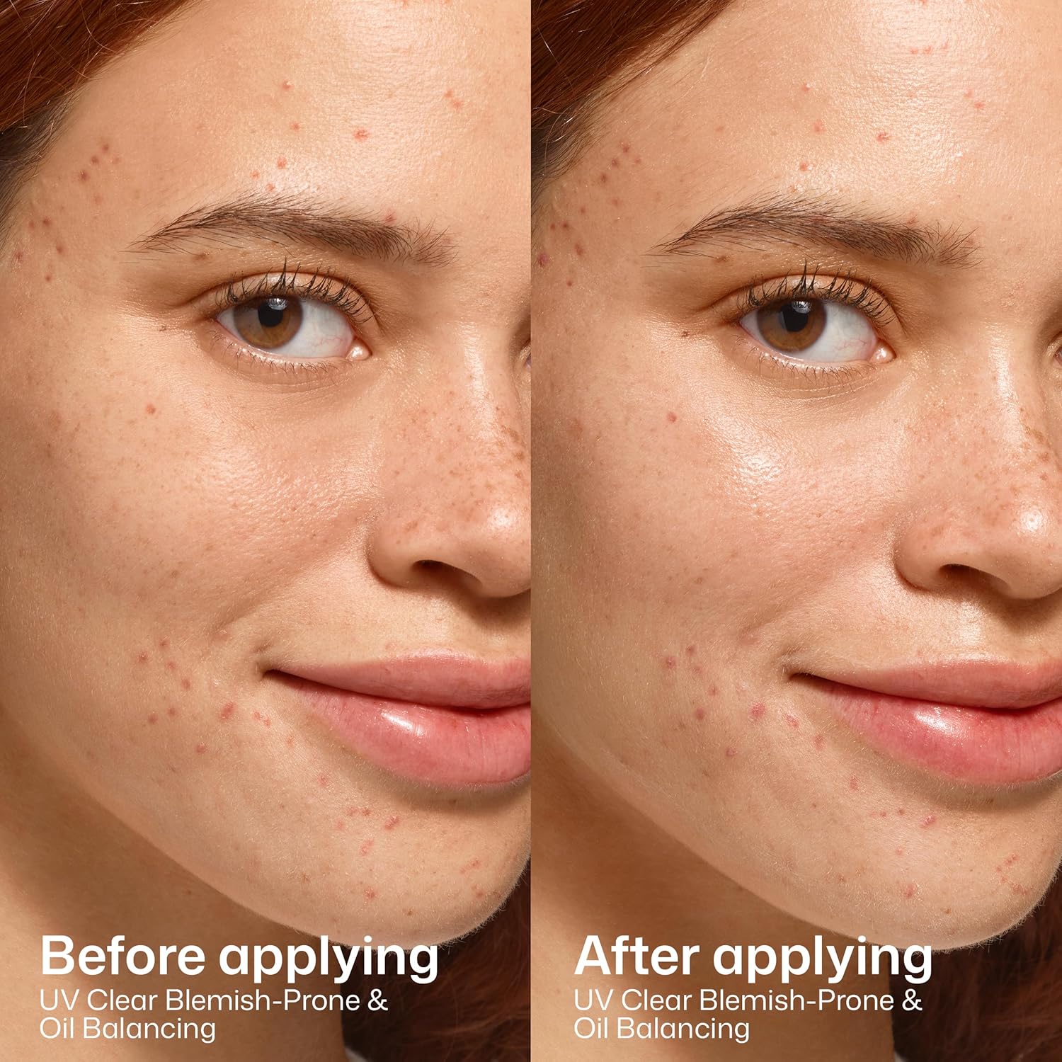 EltaMD UV Clear Face Sunscreen, Oil Free Sunscreen for Sensitive Skin with Zinc Oxide, Dermatologist Recommended