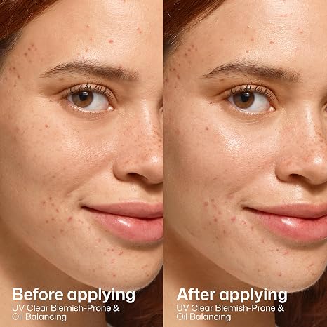 EltaMD UV Clear Face Sunscreen SPF, Oil-Free Sunscreen with Zinc Oxide, Dermatologist Recommended
