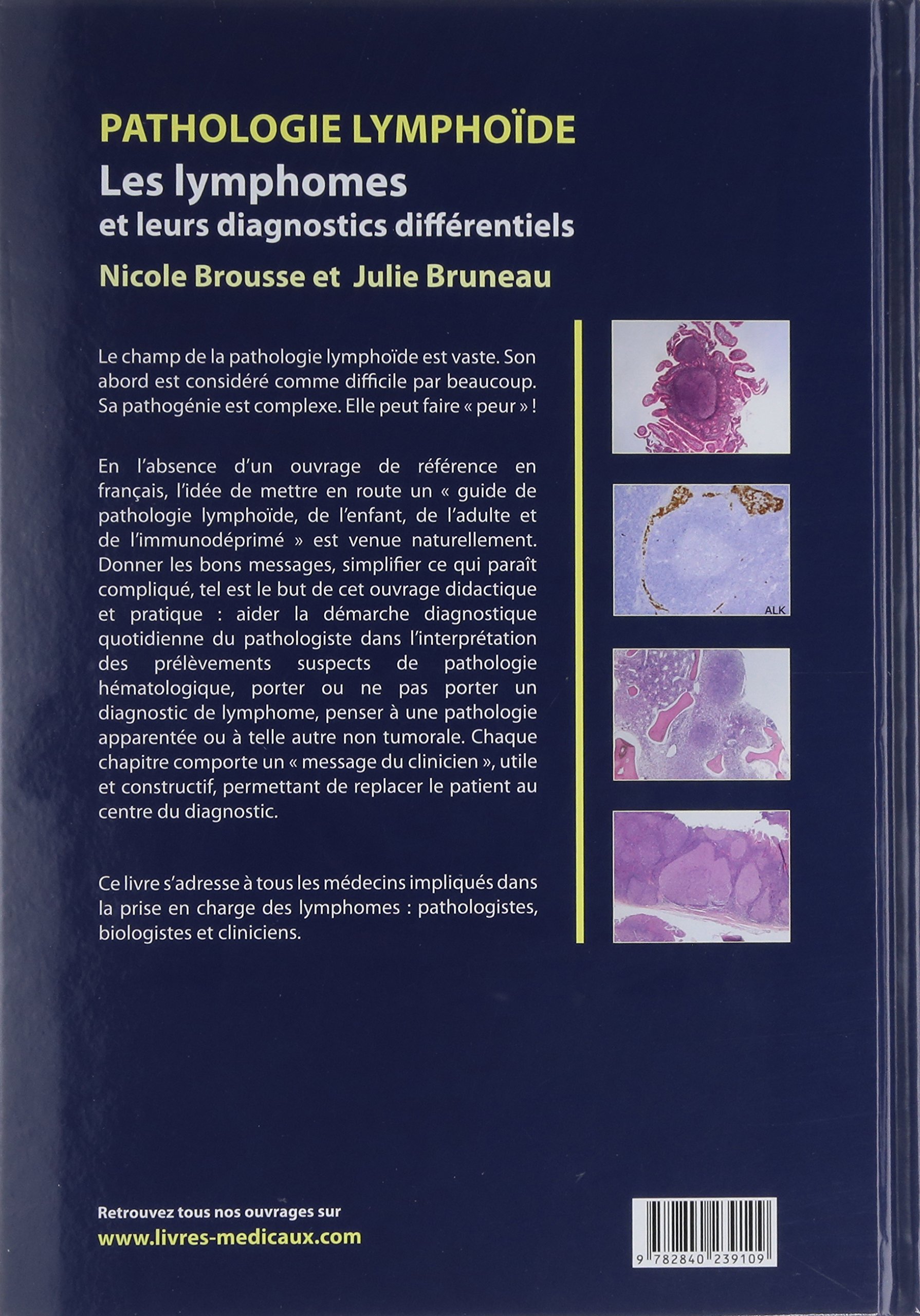 PATHOLOGIE LYMPHOIDE - LES LYMPHOMES ET LEURSDIAGNOCTICS DIFFERENTIELS