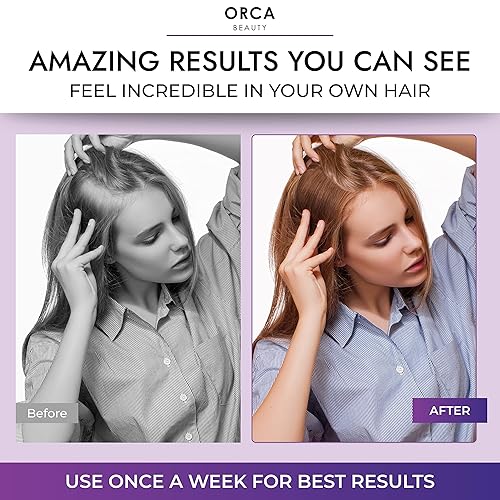 Miniatura 5 de Champú y acondicionador de biotina para adelgazar el cabello y la pérdida de cabello  Champú y acondicionador diario para mujeres para pérdida de