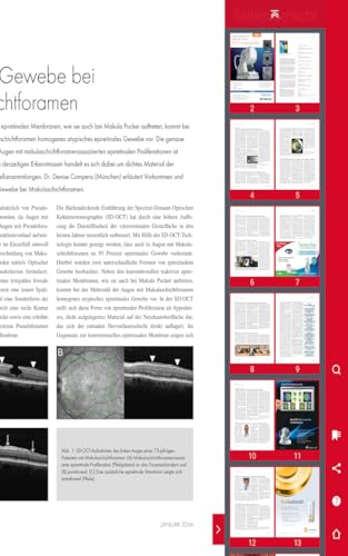 DER AUGENSPIEGEL - Zeitschrift für Klinik und Praxis